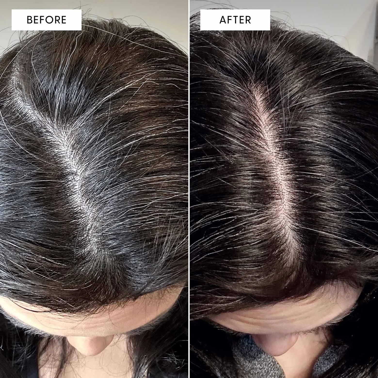 To The Root Serum 3-Pack